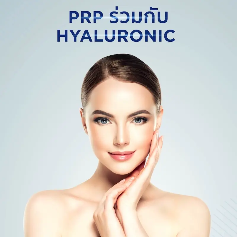 PRP ร่วมกับ HYALURONIC
