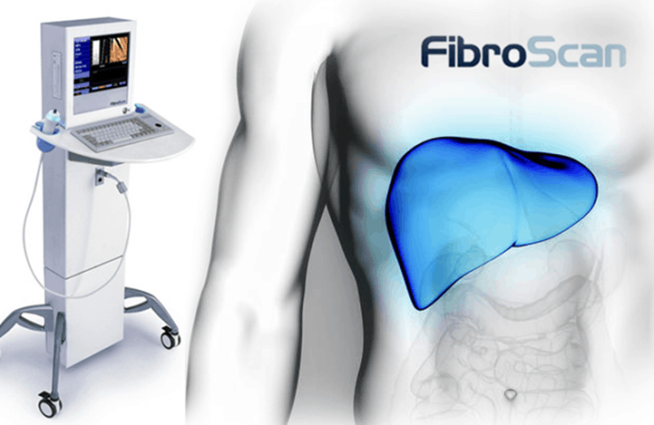 Fibro Scan