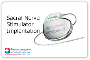 InterStim Therapy
