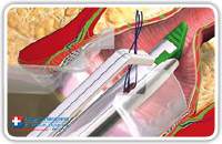 The diagnostic phase
