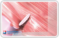 The diagnostic phase