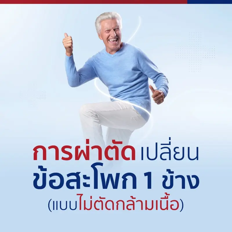 การผ่าตัดเปลี่ยนข้อสะโพก 1 ข้าง (แบบไม่ตัดกล้ามเนื้อ)