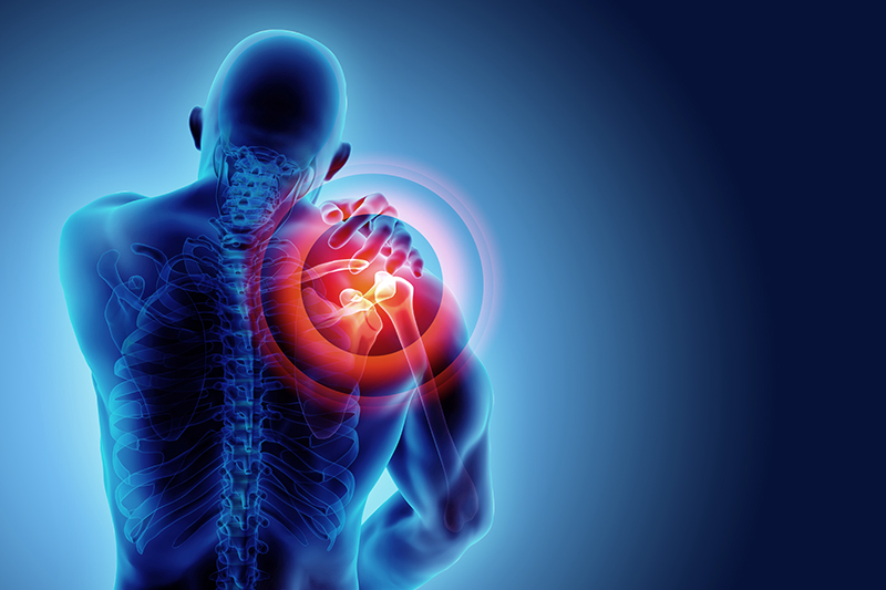 กระดูกงอกทับเอ็นข้อไหล่