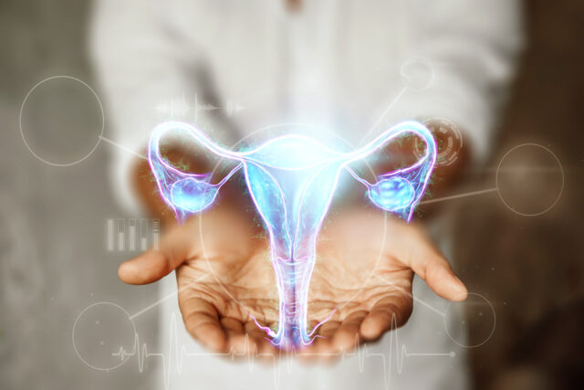 Cervical cancer Image