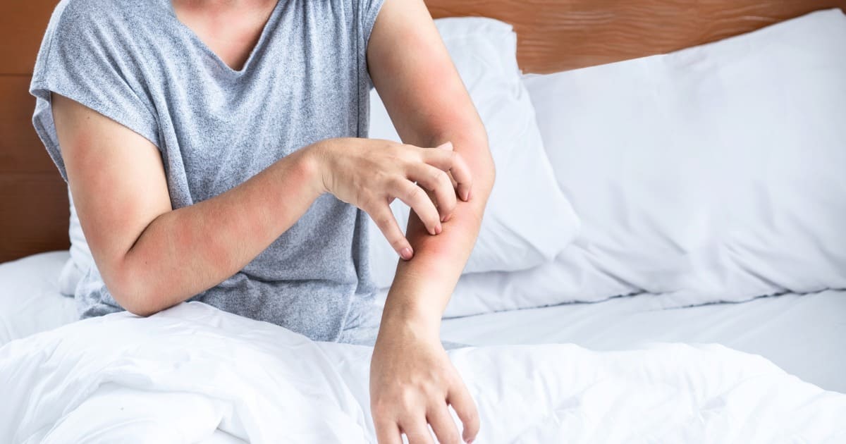 แพ้ยาอันตรายรุนแรง รู้ทันอาการก่อนสาย