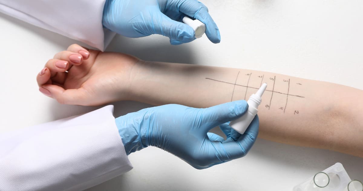 แพ้ยาอันตรายรุนแรง รู้ทันอาการก่อนสาย