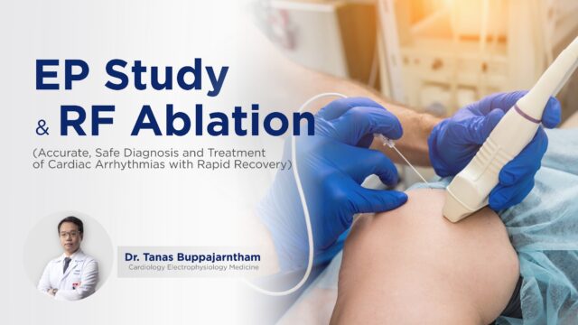 EP Study และ RF Ablation: การตรวจและรักษาหัวใจเต้นผิดจังหวะที่แม่นยำ ปลอดภัย และฟื้นตัวไว