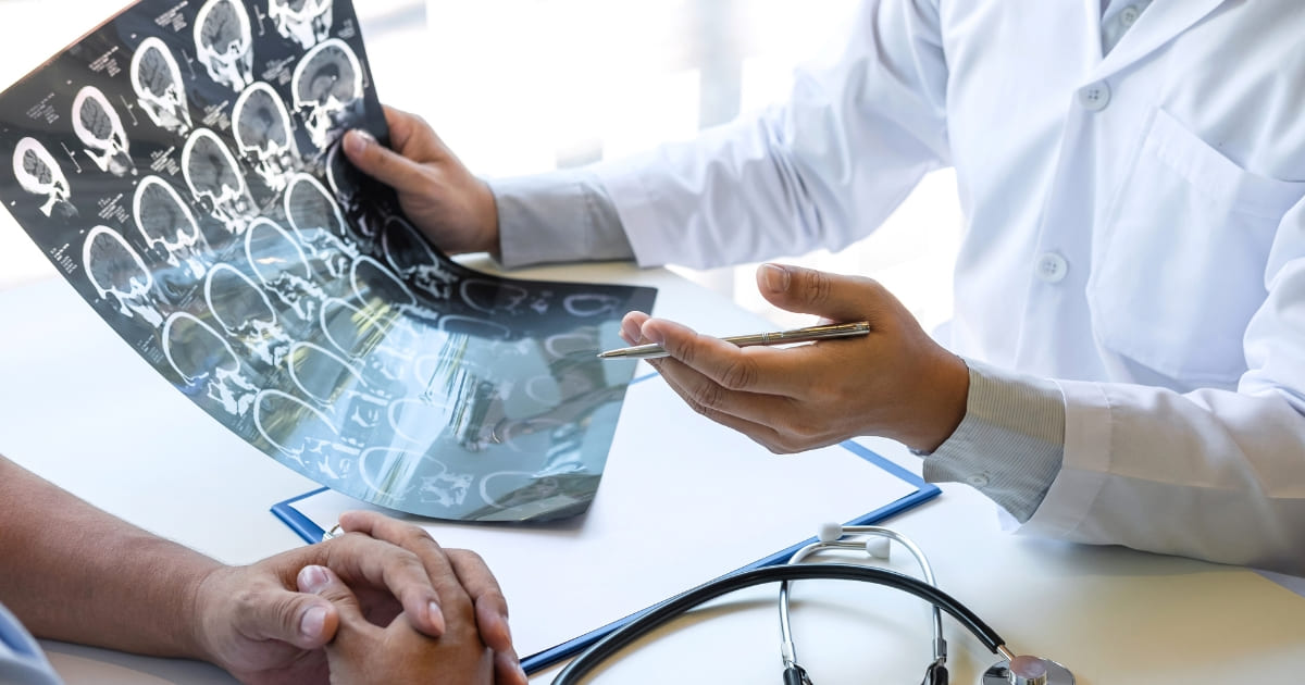 มะเร็งสมอง