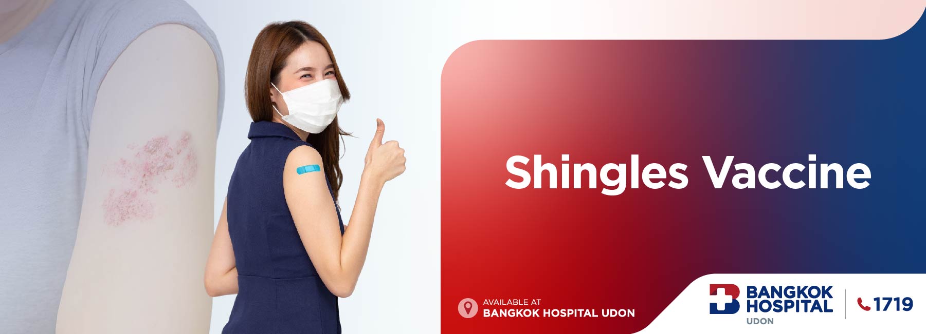 带状疱疹预防疫苗