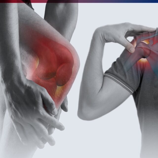 โปรแกรมตรวจ MRI เข่า และ ไหล่