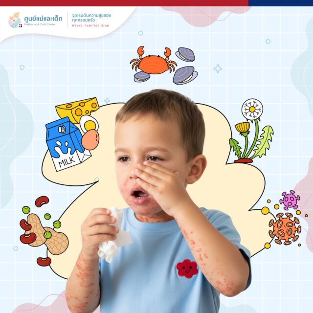 Skin Prick Test: Aero Allergen