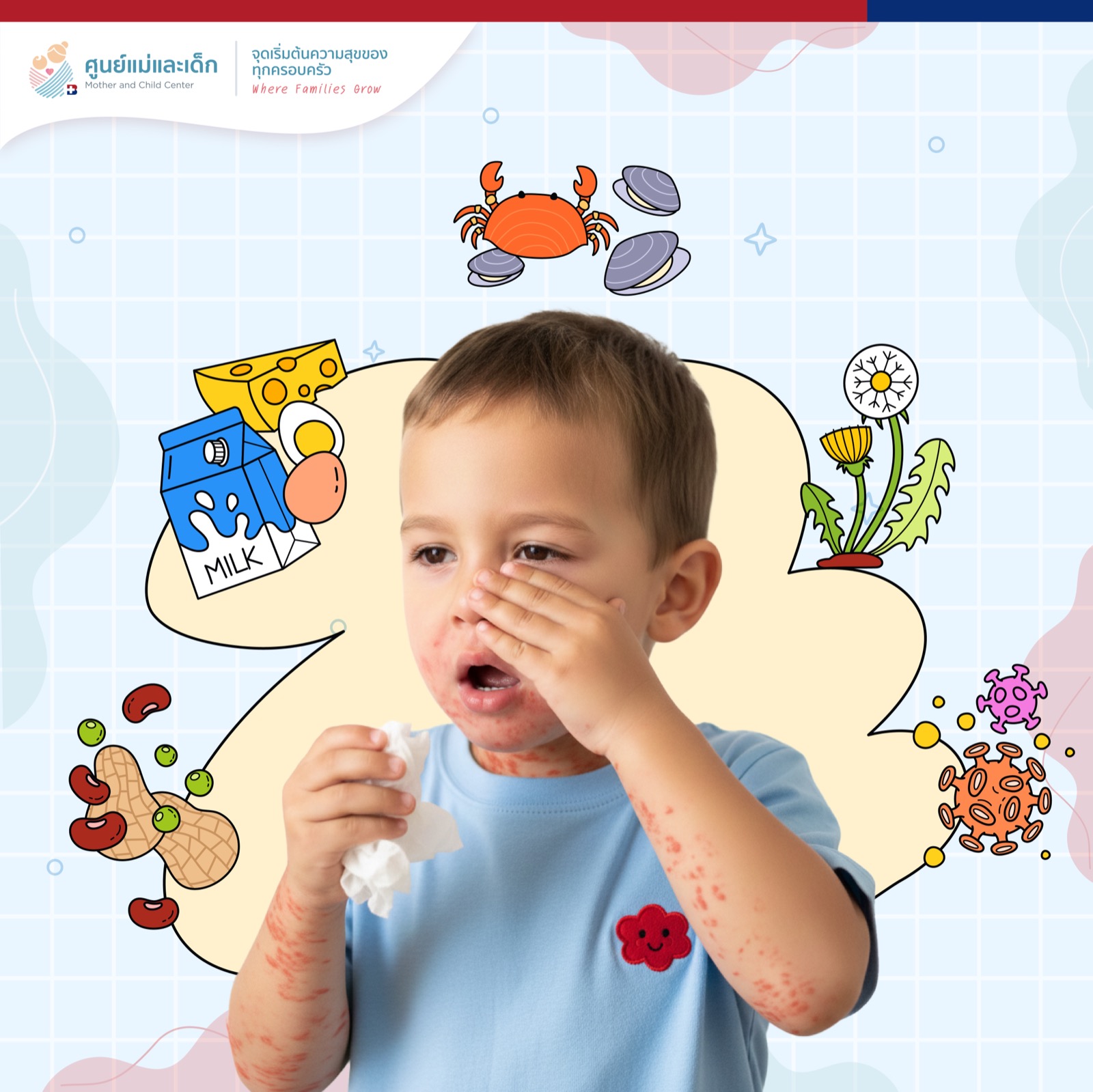 Skin Prick Test: Aero Allergen