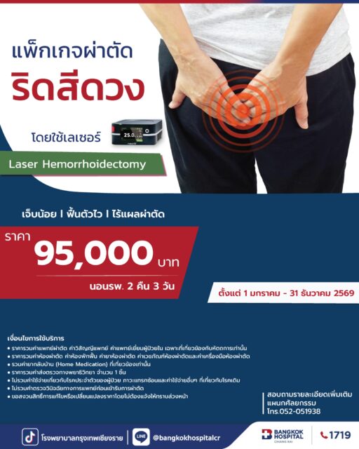 Laser Hemorrhoidectomy 2026