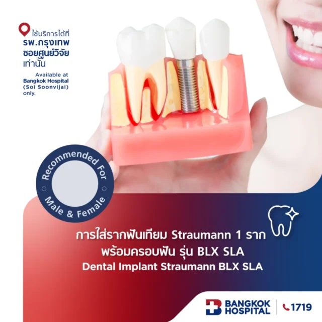 การใส่รากฟันเทียม Straumann 1 ราก พร้อมครอบฟัน รุ่น Roxolid SLActive หรือ BLX SLA