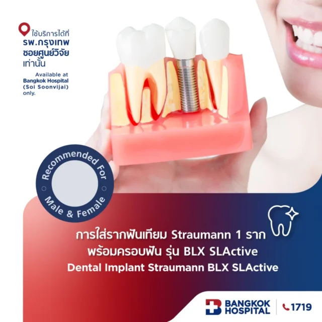 การใส่รากฟันเทียม Straumann 1 ราก พร้อมครอบฟัน รุ่น BLX SLActive