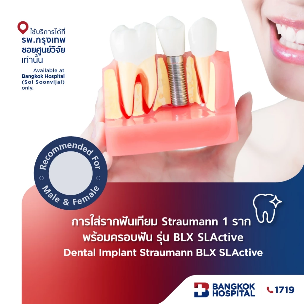 การใส่รากฟันเทียม Straumann 1 ราก พร้อมครอบฟัน รุ่น BLX SLActive
