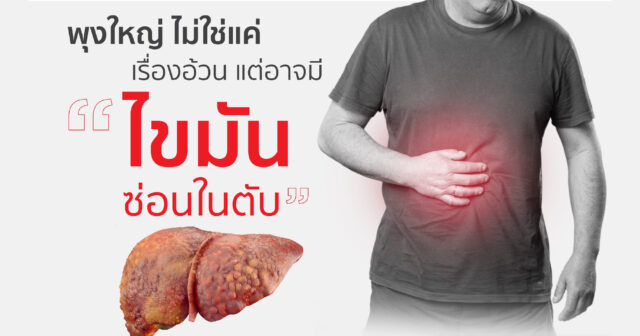 Liver Health Check with Liver Scan – Advanced Non-Invasive Technology