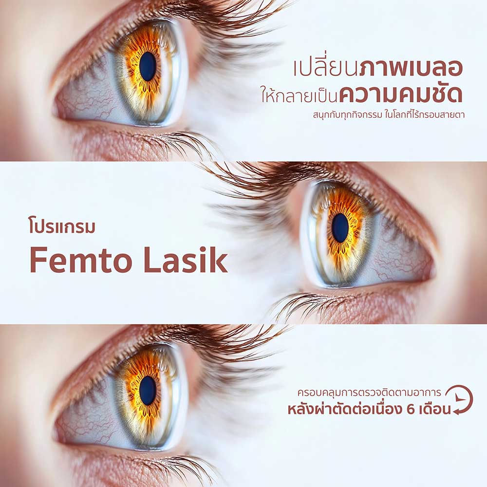 แพ็กเกจโปรแกรม Famto Lasik