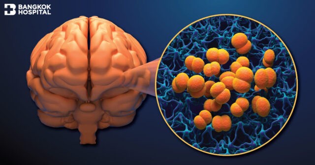 Brain health alert - Keep guard on meningitis Image