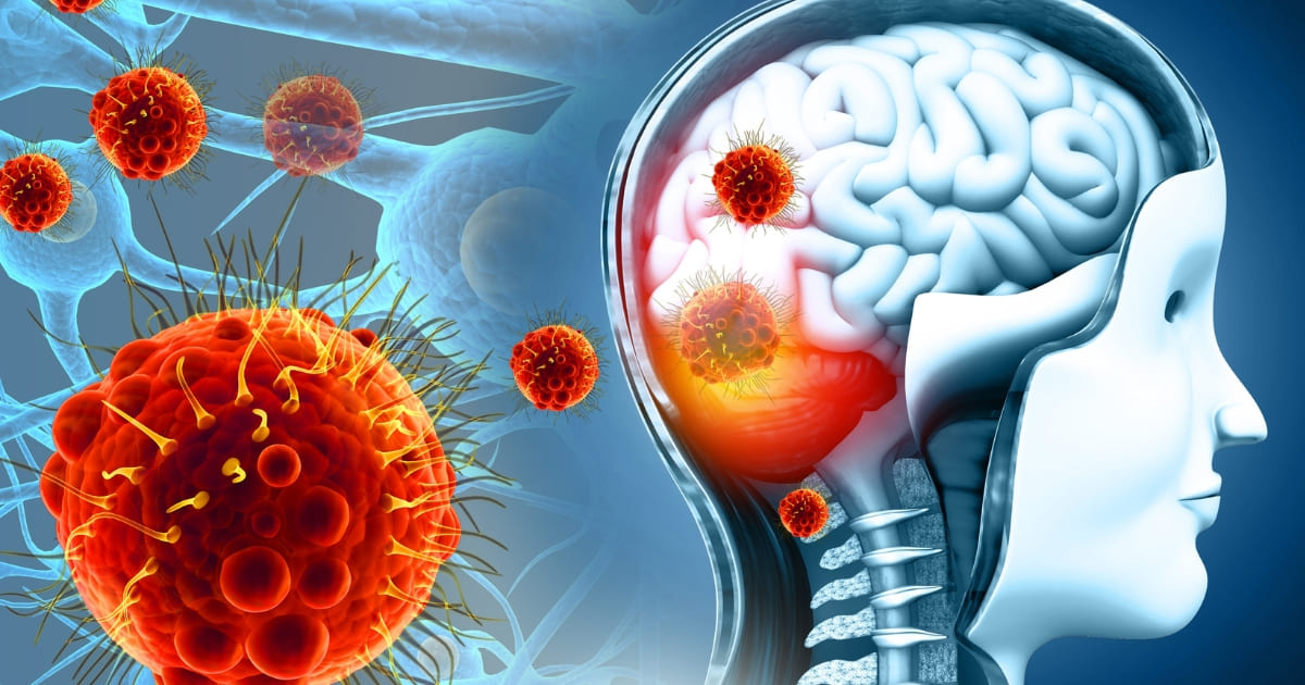 เยื่อหุ้มสมองอักเสบในเด็ก อาการเตือนที่พ่อแม่ต้องรู้ก่อนสาย