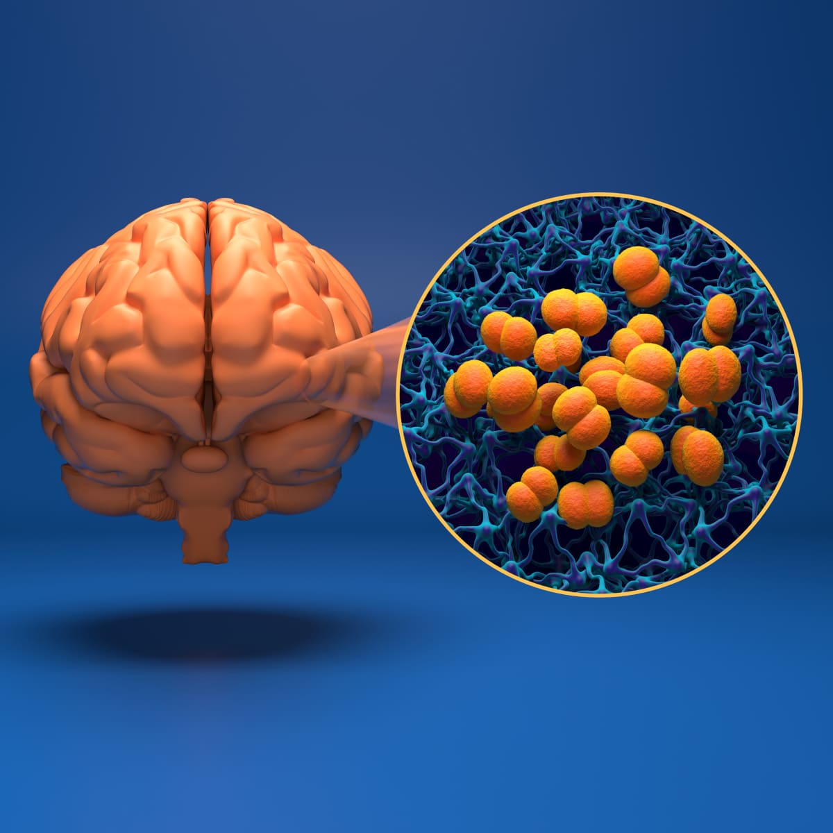 แพ็กเกจวัคซีนป้องกันเยื่อหุ้มสมองอักเสบ (ไข้กาฬหลังแอ่น) สำหรับผู้ใหญ่