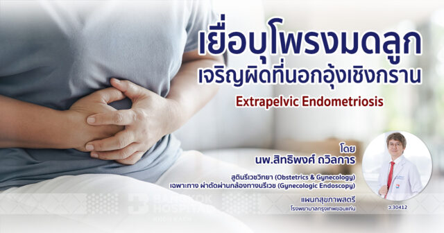 เยื่อบุโพรงมดลูกเจริญผิดที่นอกอุ้งเชิงกราน   (Extrapelvic Endometriosis)  Image