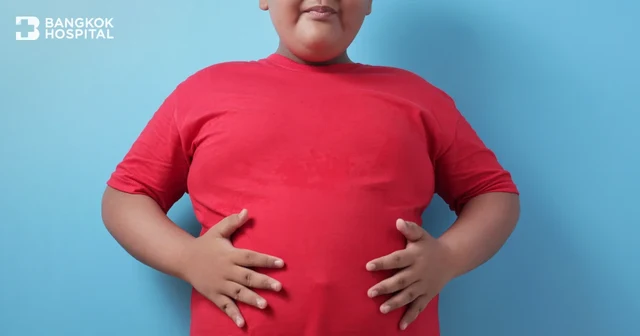 Apa penyebab obesitas pada anak, bagaimana cara merawatnya, dan bagaimana mengetahui apakah anak obesitas melebihi batas normal? Image