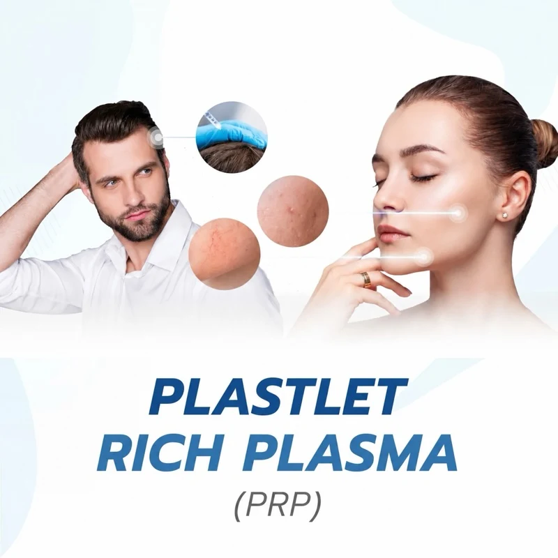 Plastlet Rich Plasma (PRP)
