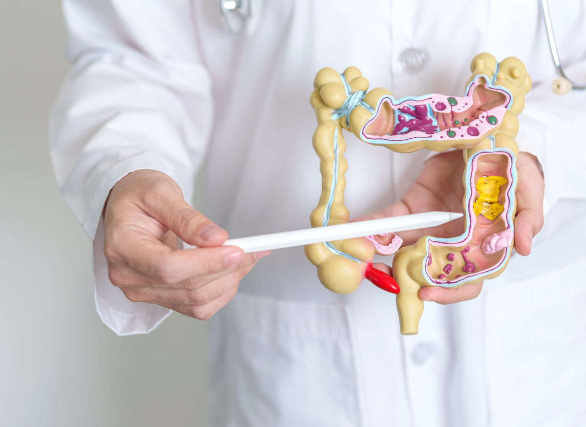 Colorectal Cancer Risk Screening Score