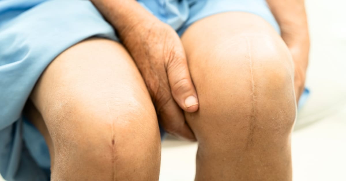 จุดเด่นของ Hip and Knee Revision Services