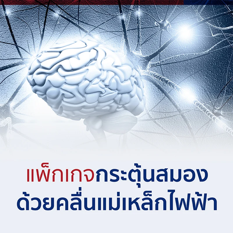 แพ็กเกจกระตุ้นสมองด้วยคลื่นแม่เหล็กไฟฟ้า (TMS)