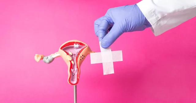 ป้องกันมะเร็งปากมดลูก โดยวิธีคัดกรองตรวจหาเชื้อ HPV อย่างง่าย ๆ ด้วยตนเอง