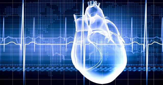 Electrophysiology Study การตรวจทางสรีรวิทยาไฟฟ้าหัวใจ