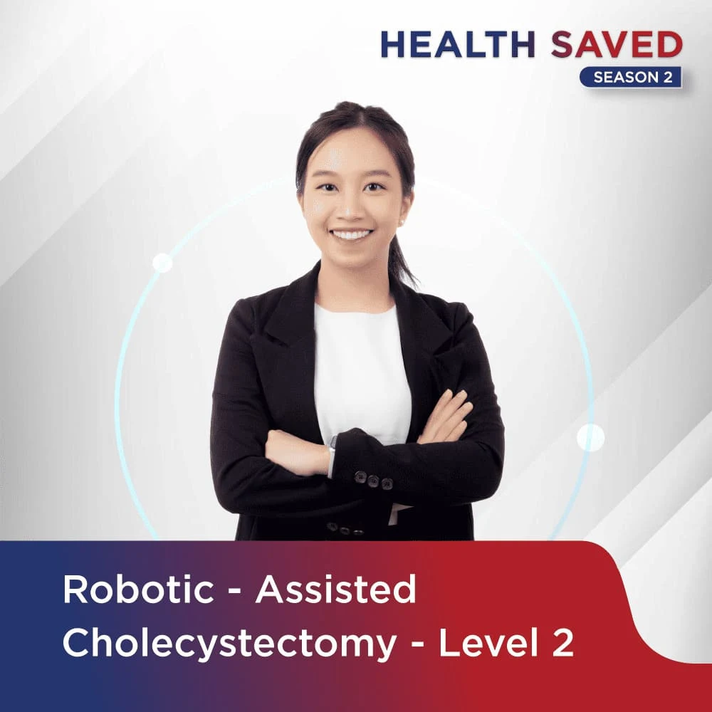 Robotic - Assisted Cholecystectomy - level 2