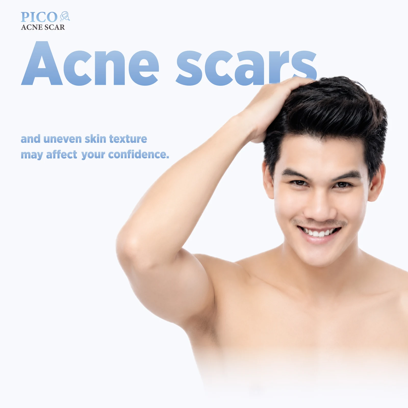 Pico Acne Scar Treatment