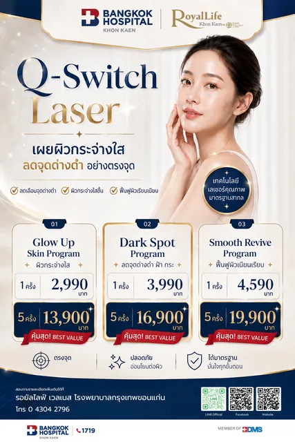 Q-Switch Laser