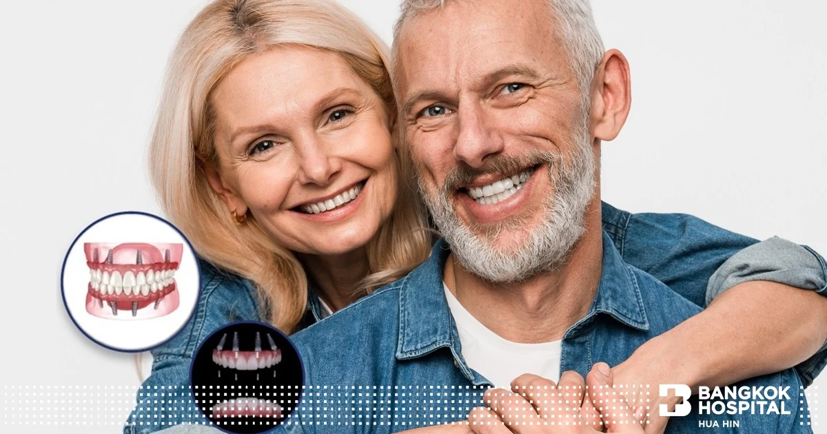 Entdecken Sie Ihr selbstbewusstes Lächeln wieder mit All-on-4-Zahnimplantaten