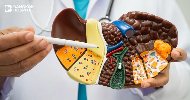 Fettlebererkrankung (Fettleber) (Fatty Liver Disease) – die stille Gefahr ohne Symptome: Ursachen, Risikogruppen, Symptome und Behandlung