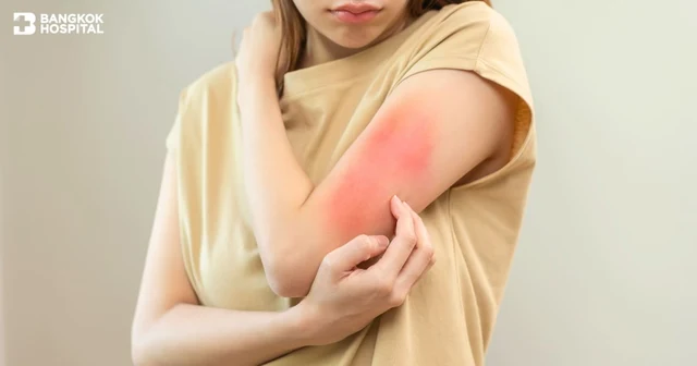 How dangerous is a penicillin allergy? Image