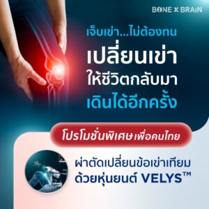 แพ็กเกจผ่าตัดเปลี่ยนข้อเข่าเทียมด้วยหุ่นยนต์ช่วยผ่าตัด VELYS