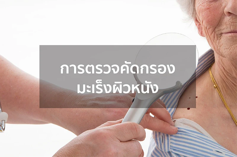 การตรวจคัดกรองมะเร็งผิวหนัง