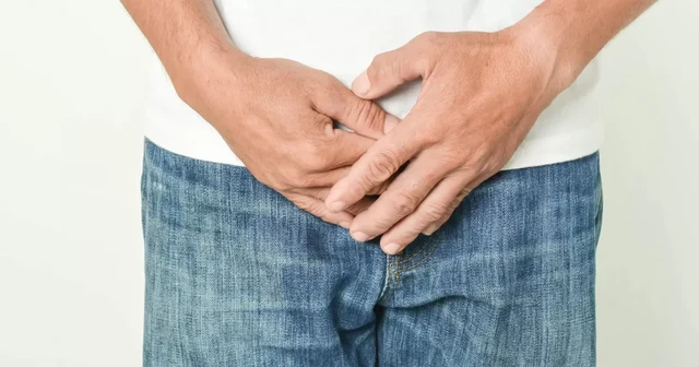 Urinary calculus Image