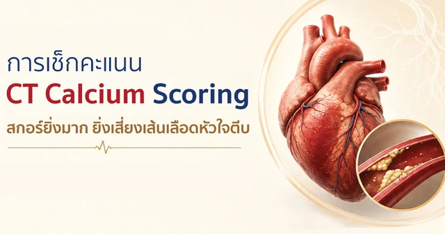 การตรวจหาคราบหินปูนที่หลอดเลือดหัวใจ (CT Calcium Scoring) Image