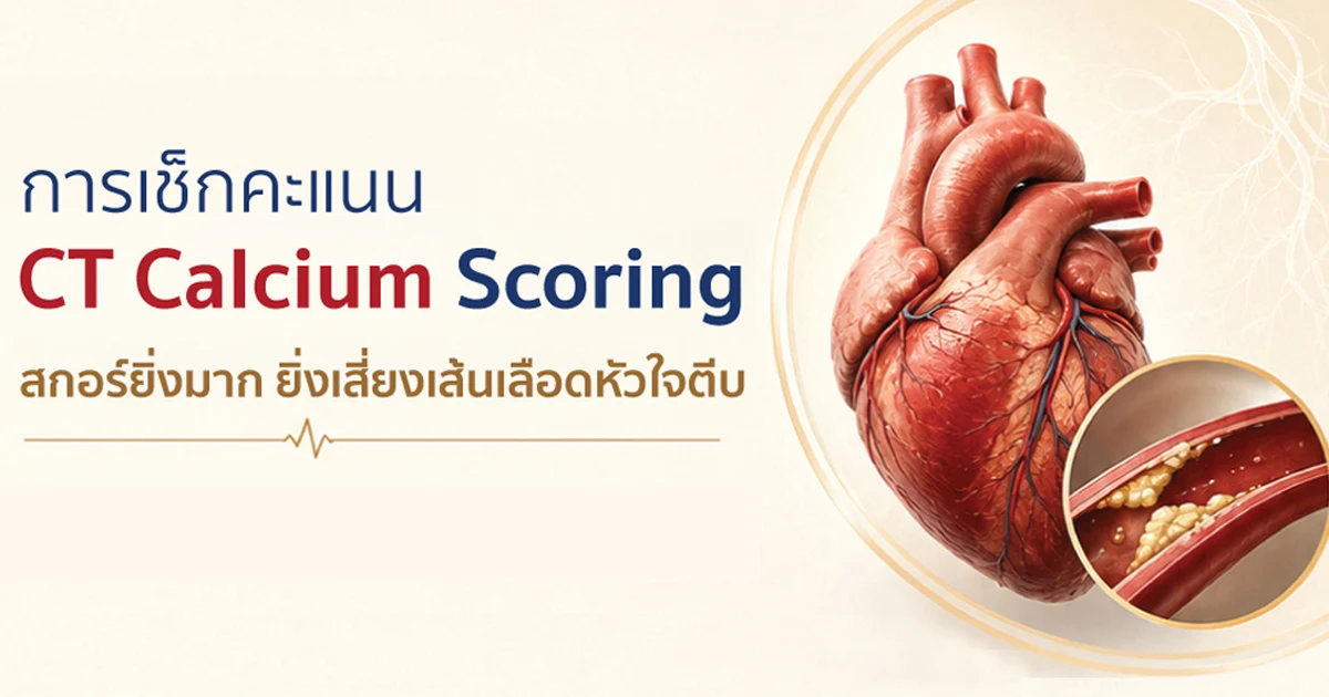การตรวจหาคราบหินปูนที่หลอดเลือดหัวใจ (CT Calcium Scoring)