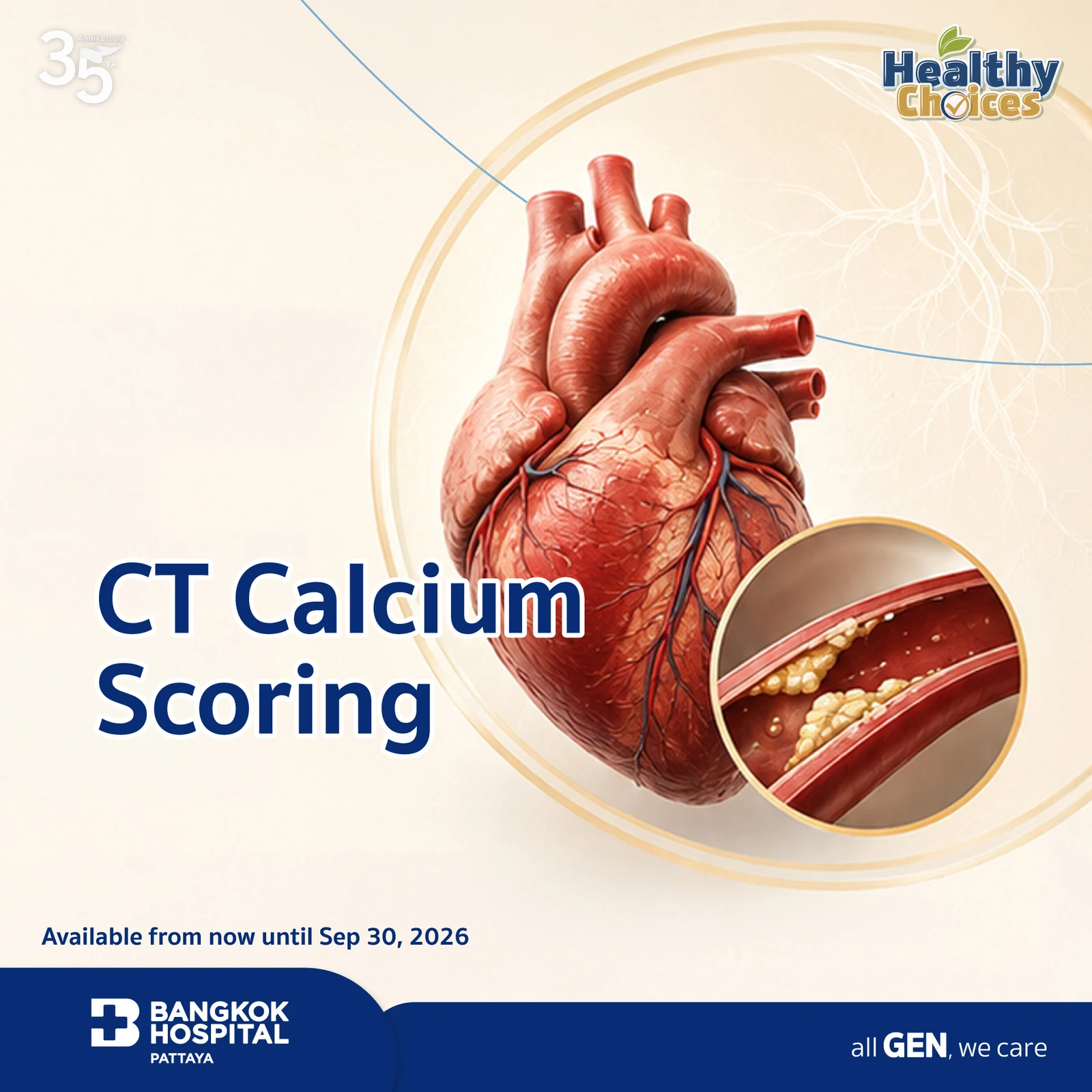 CT Calcium Scoring