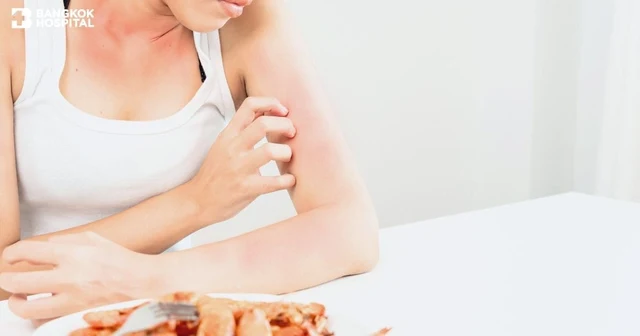 แพ้อาหารในผู้ใหญ่ (Adult - Onset Food Allergy) อาการ วิธีสังเกต ตรวจรักษา รู้ทันก่อนรุนแรง Image