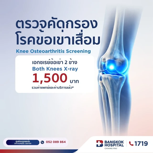 Knee Osteoarthritis Screening