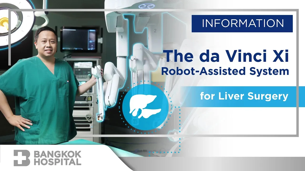 Robotergestützte Operation von Leber- und Gallengangskrebs mit dem da Vinci Xi-Roboter