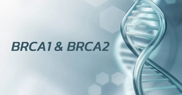 การตรวจคัดกรองยีน (BRCA) เพื่อดูปัจจัยเสี่ยงต่อการเป็นมะเร็งเต้านม