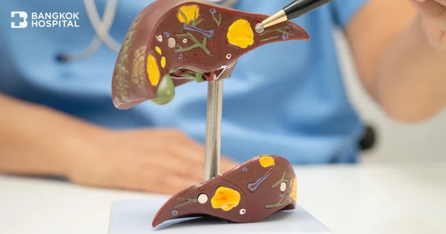What Is Liver Tumor? Essential Guide to Liver Masses and Treatment Image
